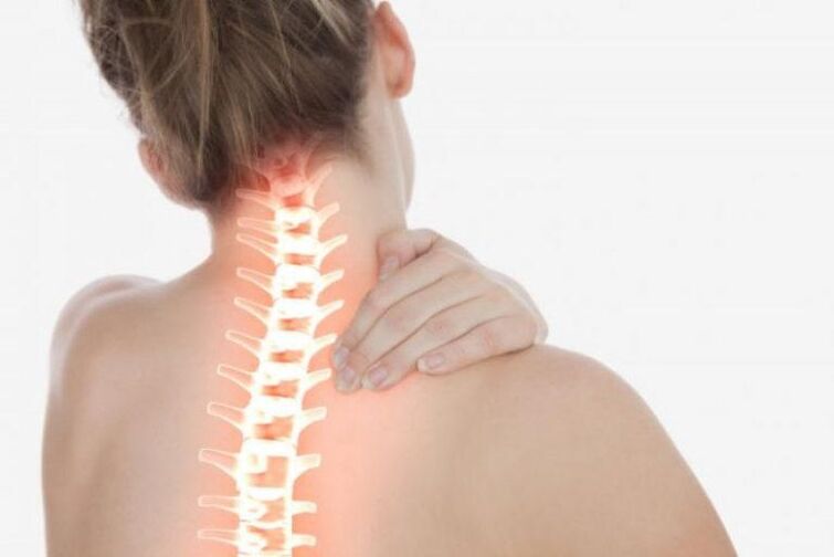 Nackenschmerzen aufgrund von Osteochondrose